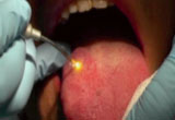 Oral Surgery